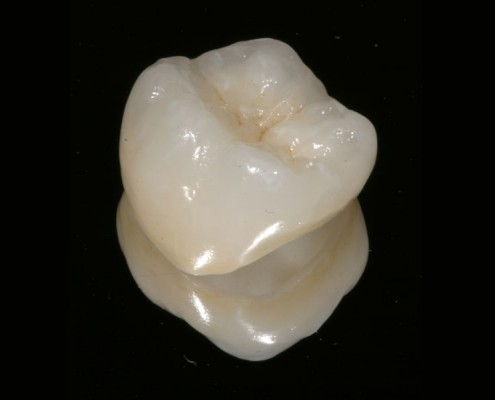 crown