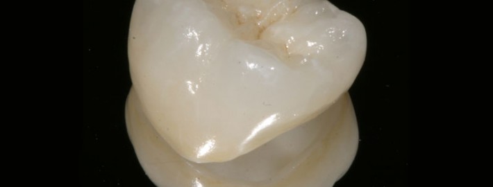 crown