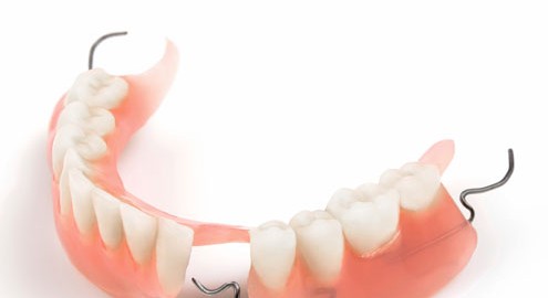 Partial dentures