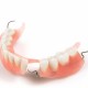 Partial dentures