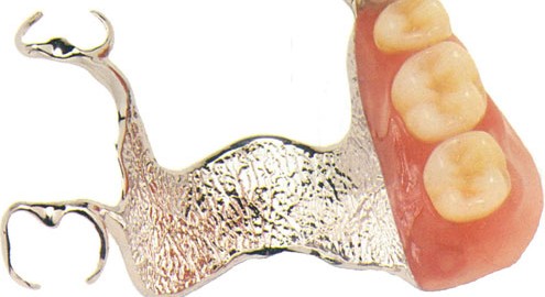 Partial dentures