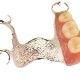 Partial dentures